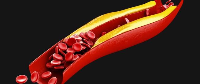 الكولسترول